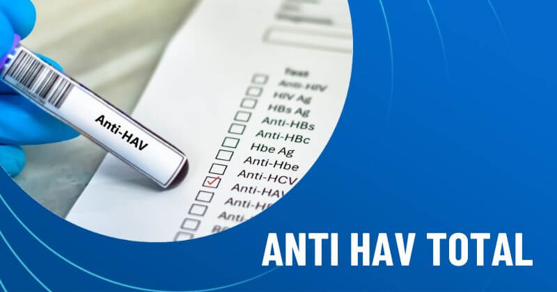 xét nghiệm anti hav total