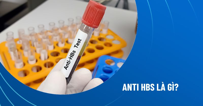 Anti HBs