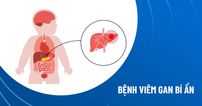 bệnh viêm gan bí ẩn
