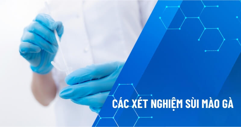 các xét nghiệm sùi mào gà