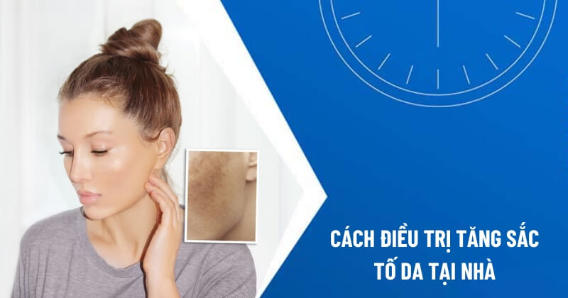 cách điều trị tăng sắc tố da tại nhà