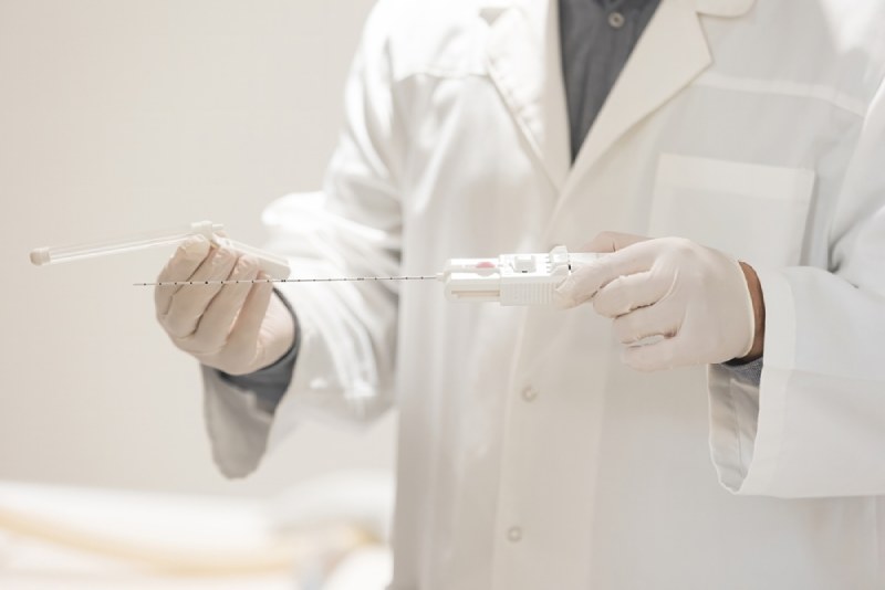 Chẩn đoán ung thư tuyến tiền liệt giai đoạn 2 bằng sinh thiết