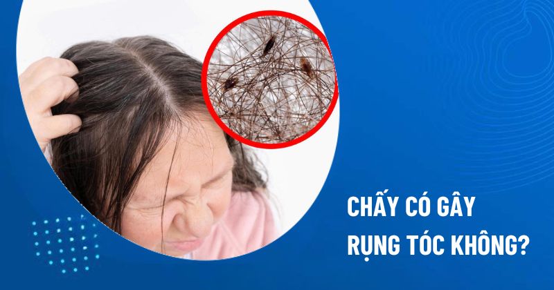 chấy có gây rụng tóc không