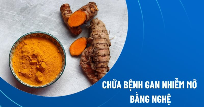5 cách chữa bệnh gan nhiễm mỡ bằng nghệ phổ biến hiện nay