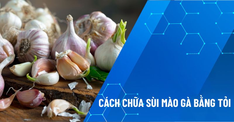 chữa sùi mào gà bằng tỏi