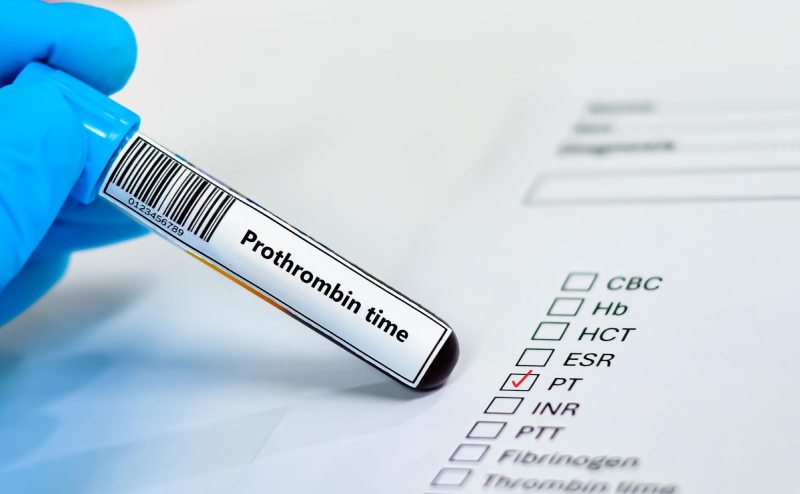 đánh giá thời gian prothrombin
