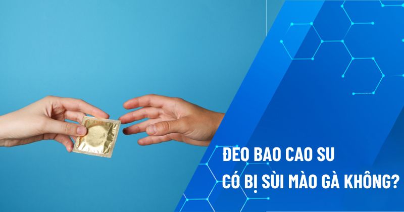 Đeo bao cao su có bị sùi mào gà không