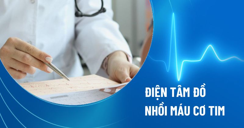 điện tâm đồ nhồi máu cơ tim