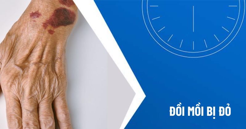 đồi mồi bị đỏ