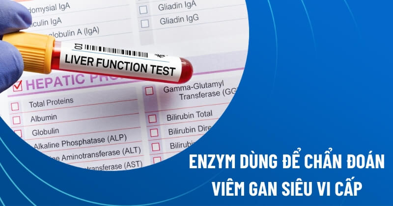 enzym dùng để chẩn đoán viêm gan siêu vi cấp