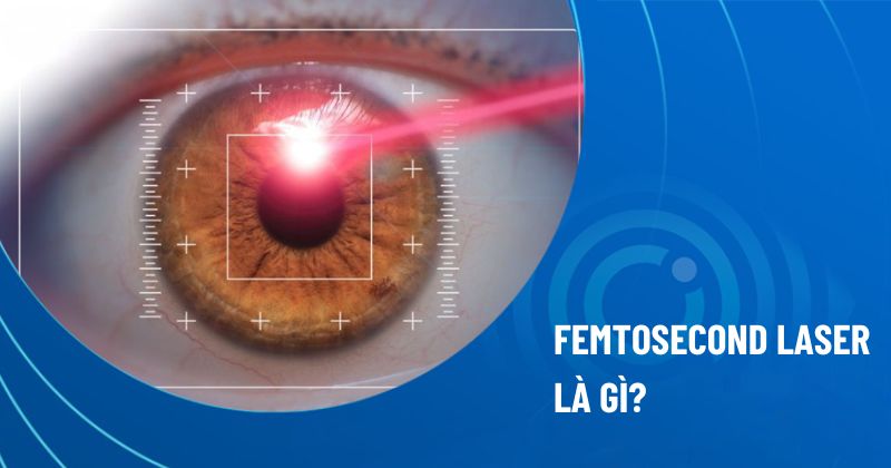 femtosecond laser