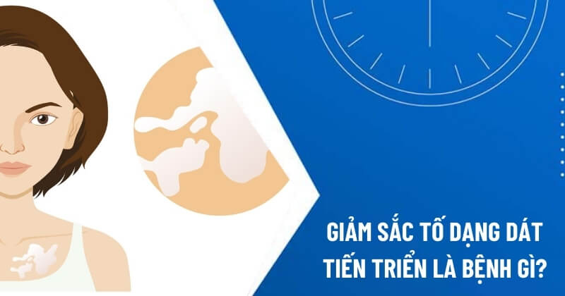 giảm sắc tố dạng dát tiến triển