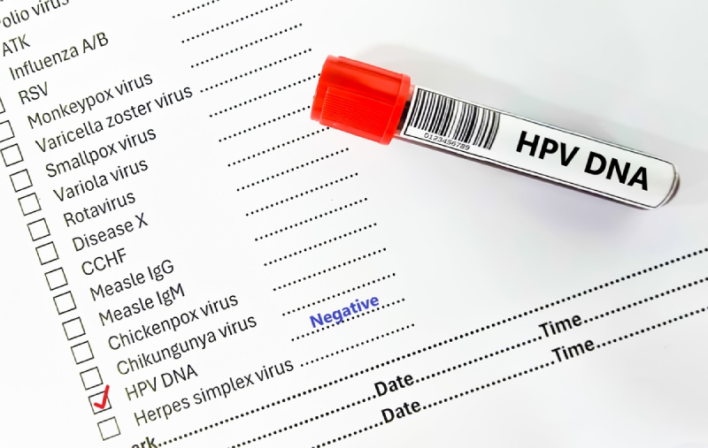 hpv âm tính không có nghĩa là không mắc sùi mào gà