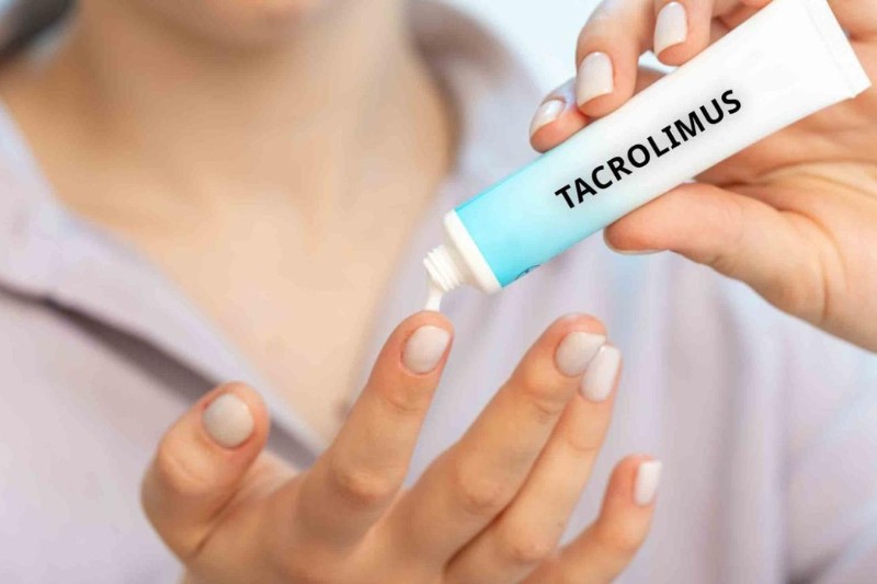 kem bôi tacrolimus trị mất sắc tố da 