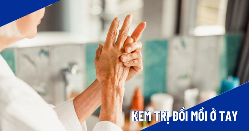 kem trị đồi mồi ở tay