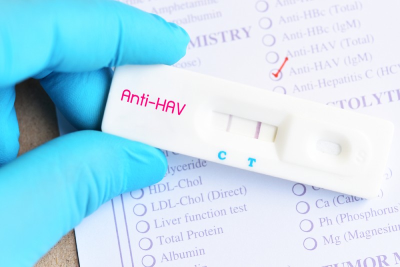 dấu hiệu viêm gan a cấp tính