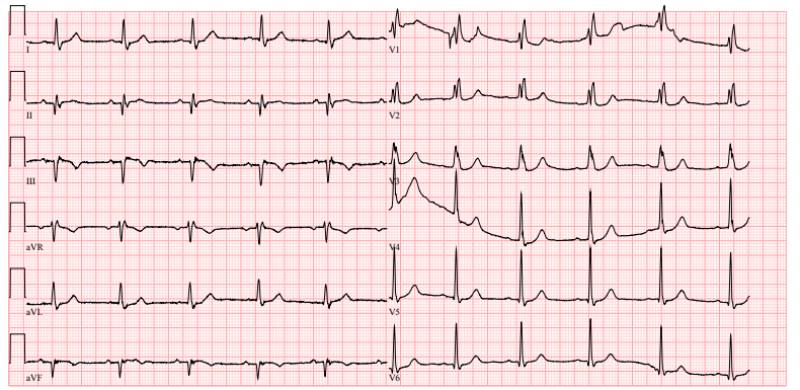 kỹ thuật hình ảnh học trên điện tâm đồ
