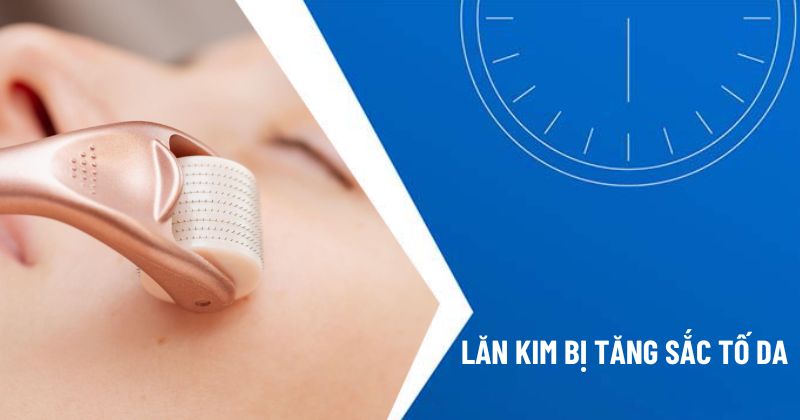 lăn kim bị tăng sắc tố da