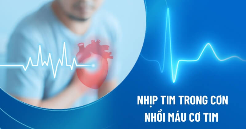 nhịp tim trong cơn nhồi máu cơ tim