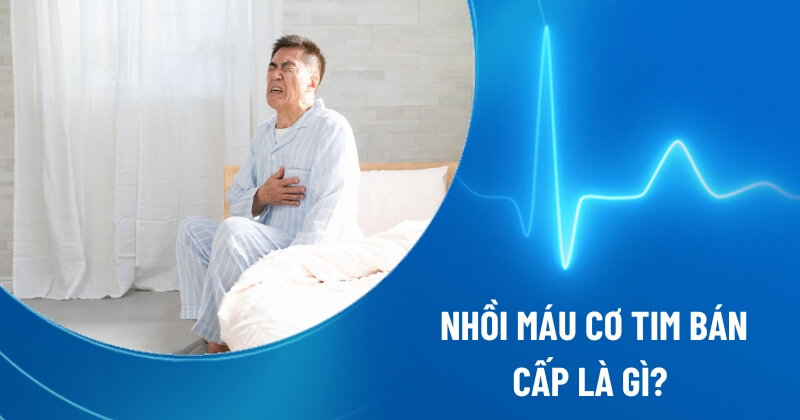 Nhồi máu cơ tim bán cấp: Khoảnh khắc sinh tử không thể chậm trễ