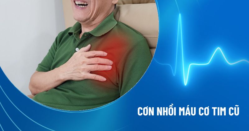 nhồi máu cơ tim cũ