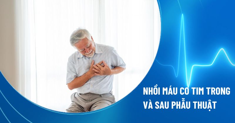 nhồi máu cơ tim trong và sau mổ