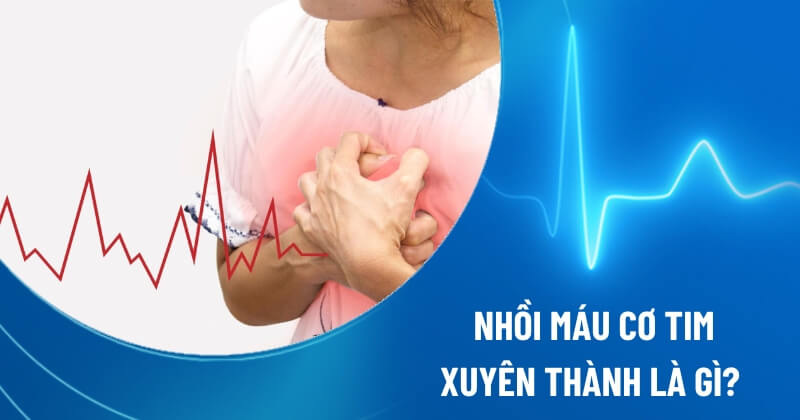 nhồi máu cơ tim xuyên thành