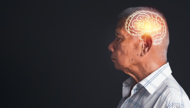 Parkinson và Alzheimer có mối liên hệ với neuromelanin trong não bộ