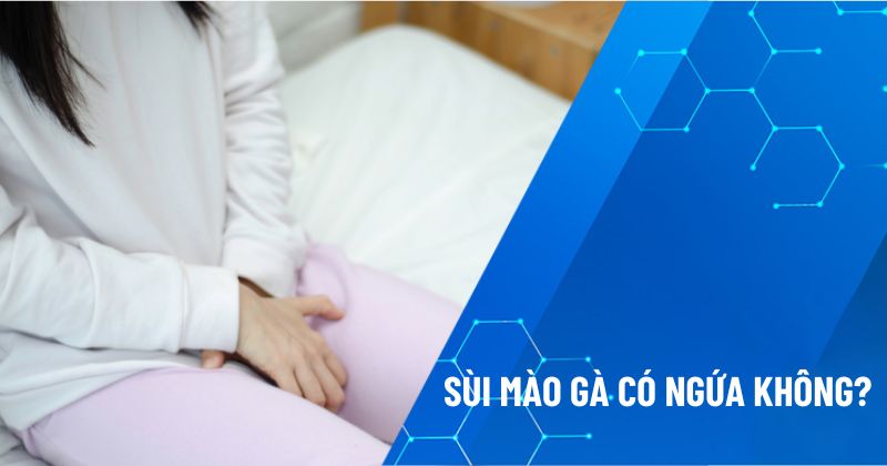 sùi mào gà có ngứa không