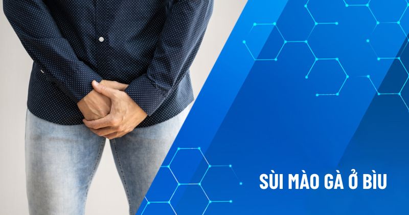 sùi mào gà ở bìu