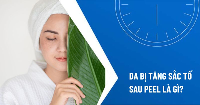 tăng sắc tố da sau peel