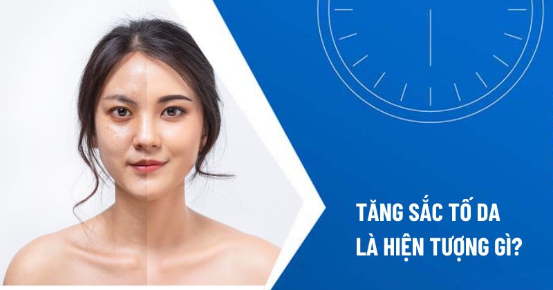 tăng sắc tố da