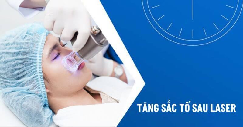 tăng sắc tố sau laser