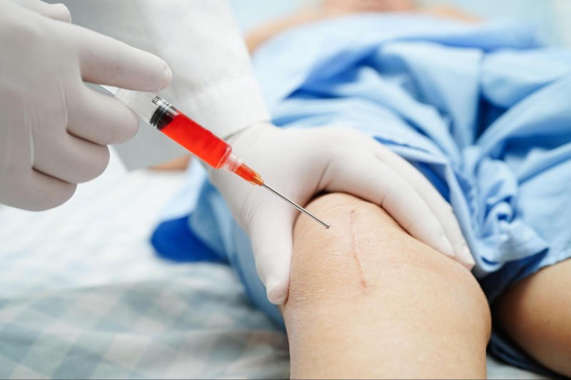 Tiêm huyết tương giàu tiểu cầu