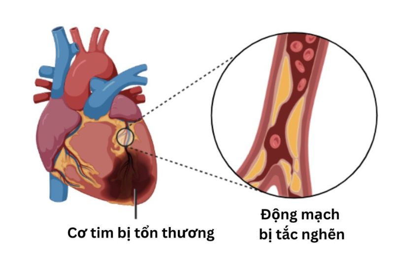 trường hợp cần phẫu thuật
