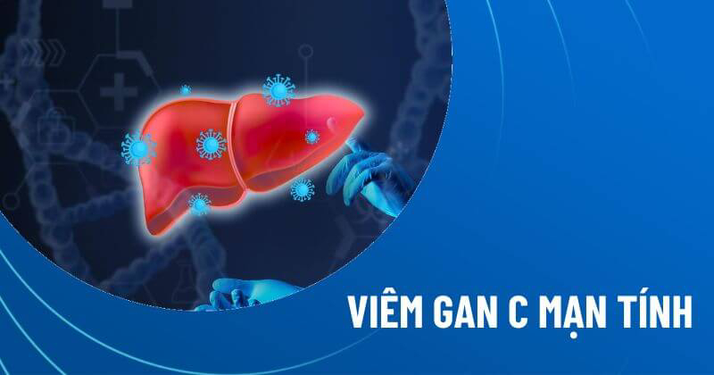viêm gan C mạn tính