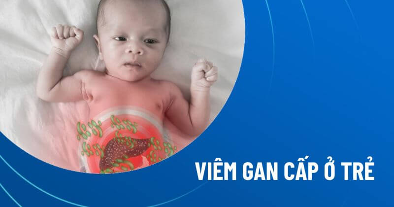 viêm gan cấp ở trẻ em