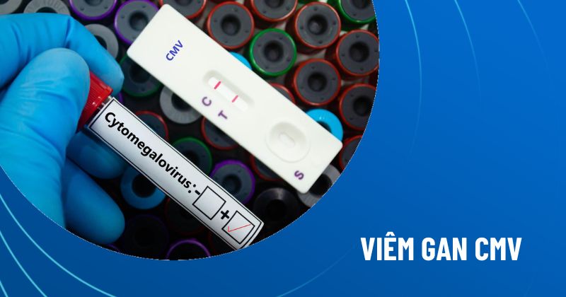 viêm gan cmv