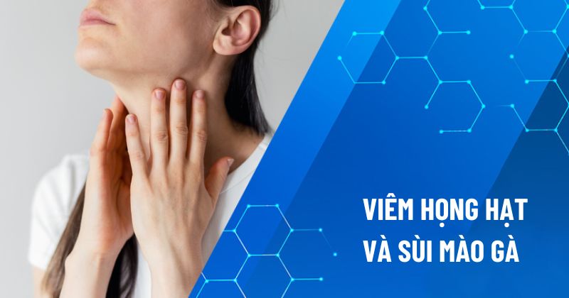 viêm họng hạt và sùi mào gà