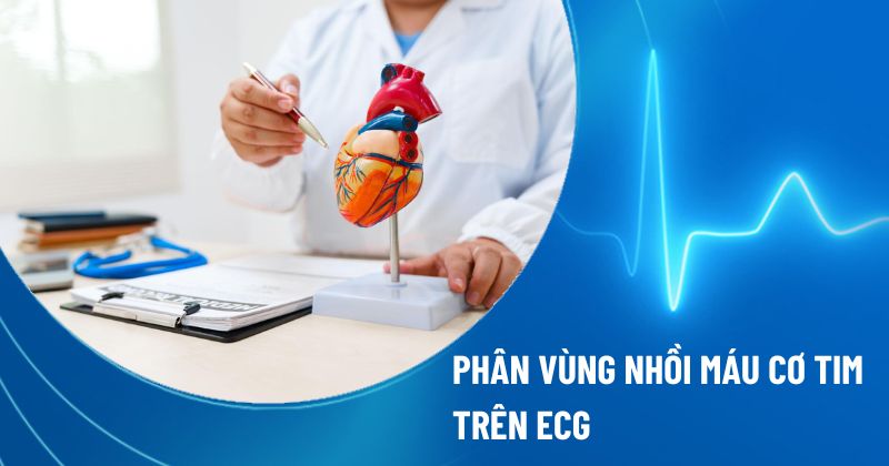 vùng nhồi máu cơ tim