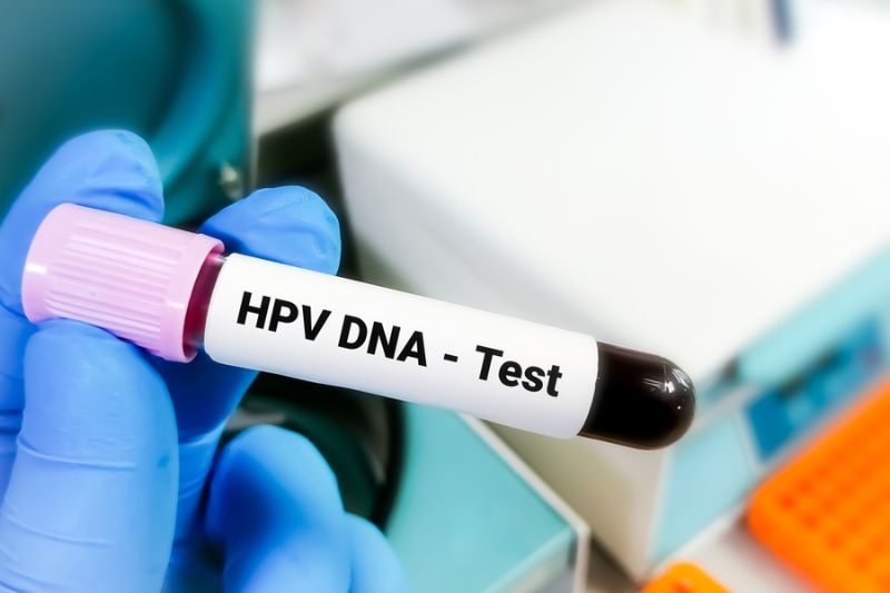 xét nghiệm HPV