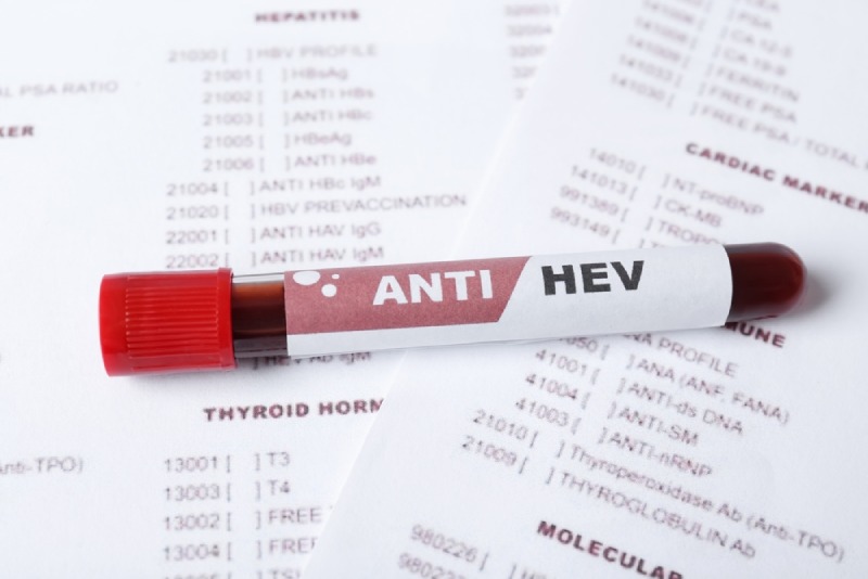 Xét nghiệm anti -HEV IgM, IgG phát hiện kháng thể virus