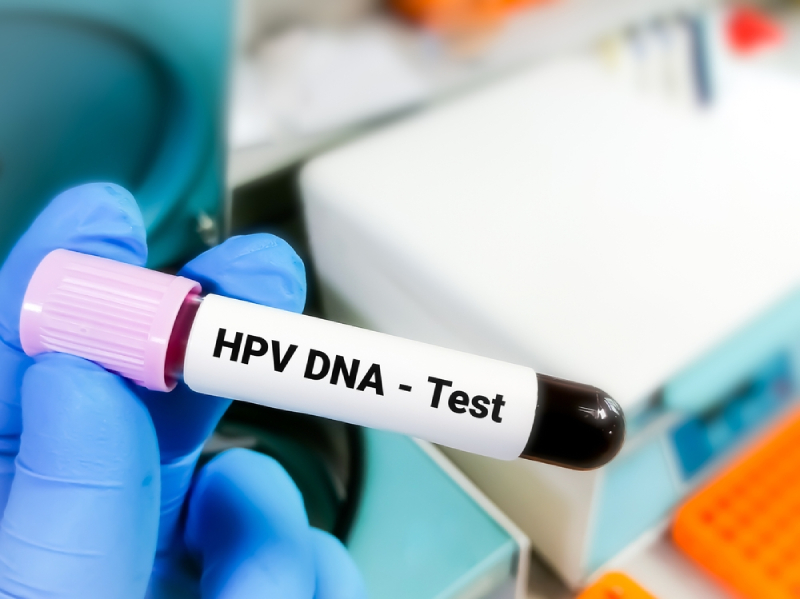 xét nghiệm hpv pcr phân tích mã di truyền