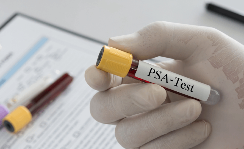 xét nghiệm psa test