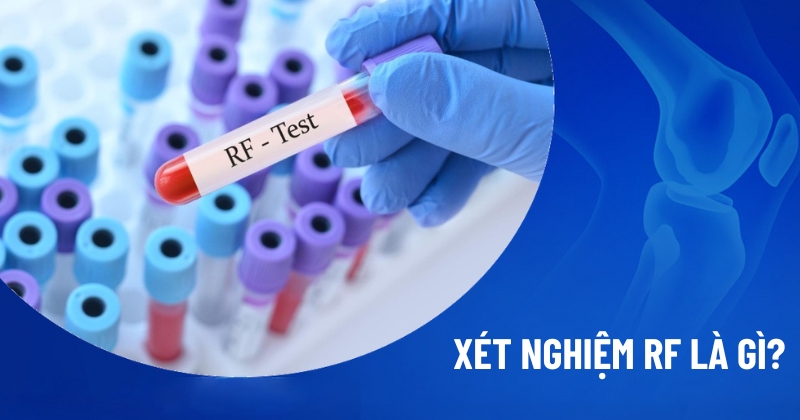 Xét nghiệm RF