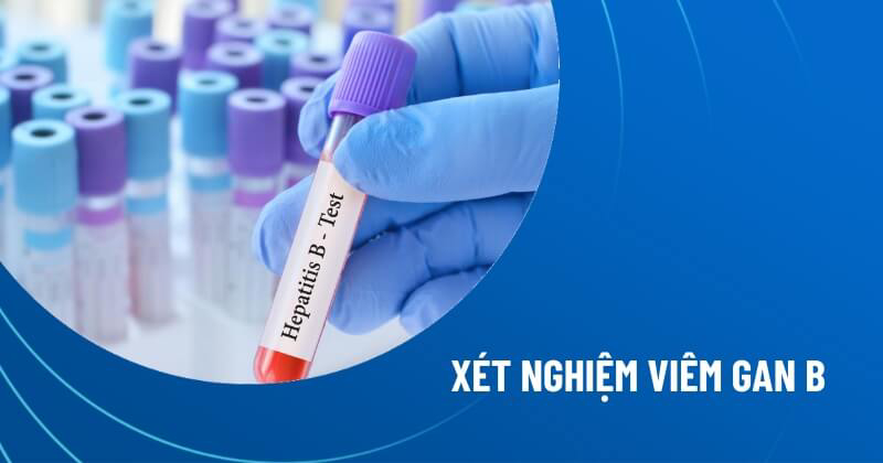 xét nghiệm viêm gan b