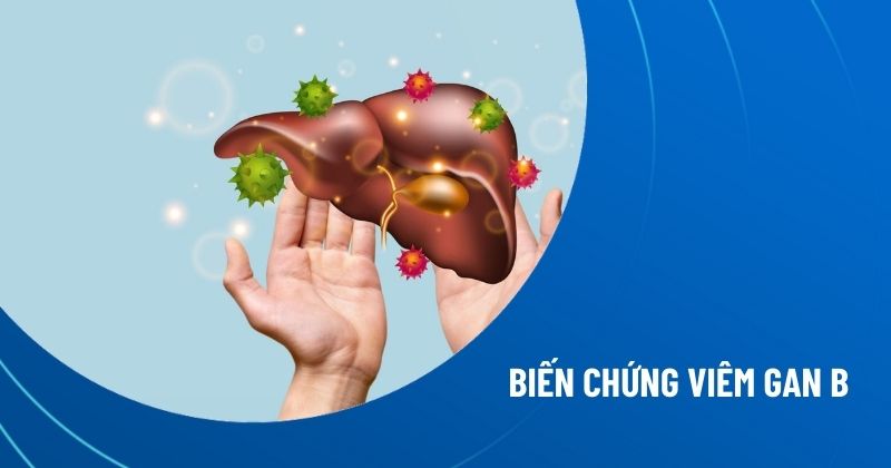 biến chứng viêm gan B