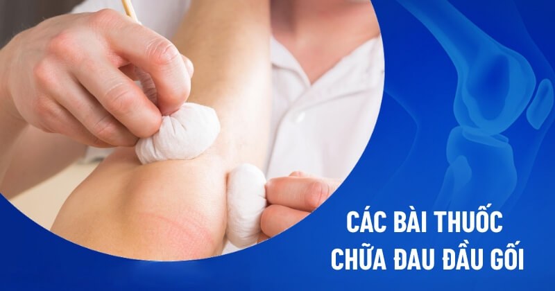 bài thuốc chữa đau đầu gối