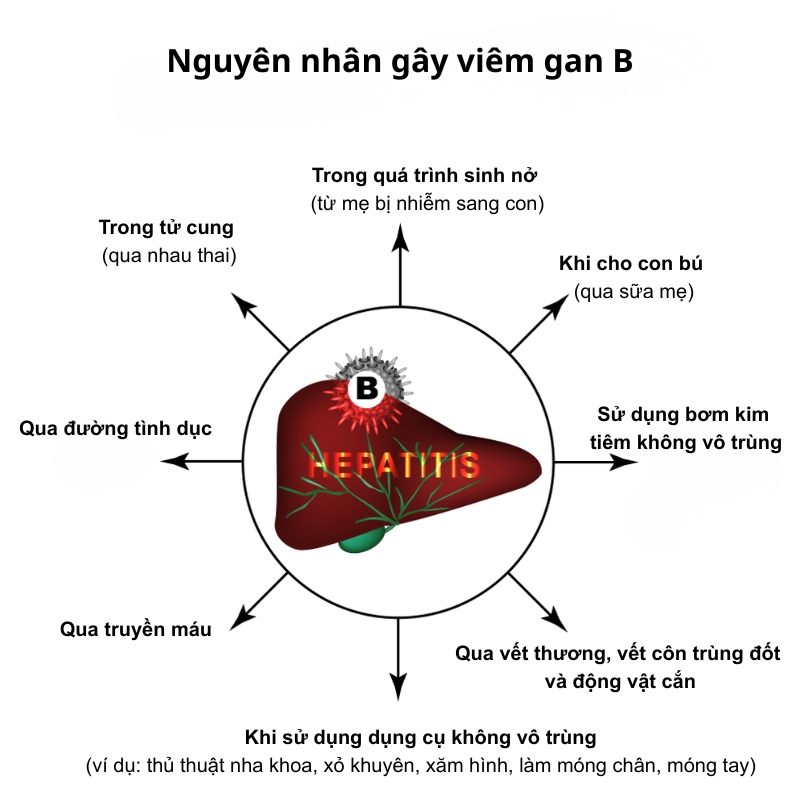 các nguyên nhân gây viêm gan b