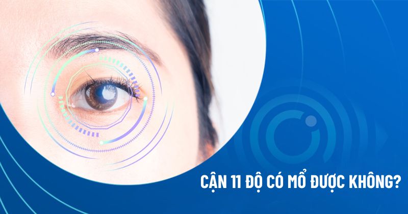 cận 11 độ có mổ được không